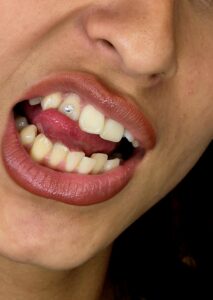 Gem Dentistry