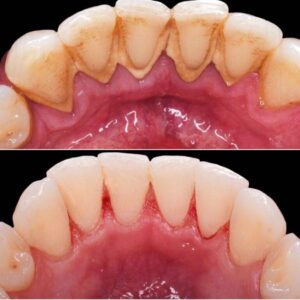 Gem Dentistry