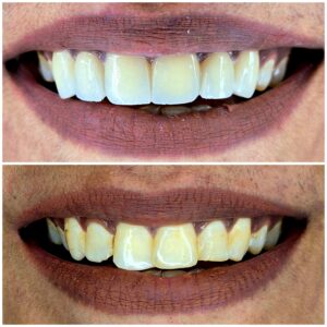 Gem Dentistry